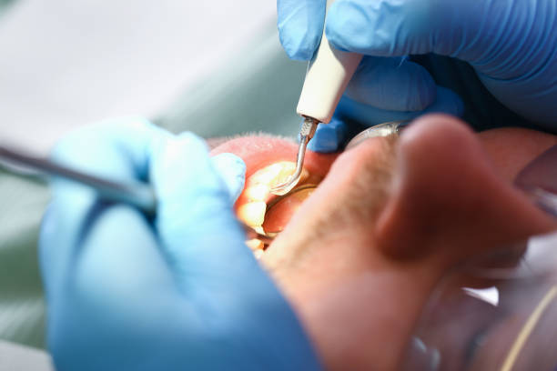 Best Emergency Broken Tooth Repair in Avondale, AZ